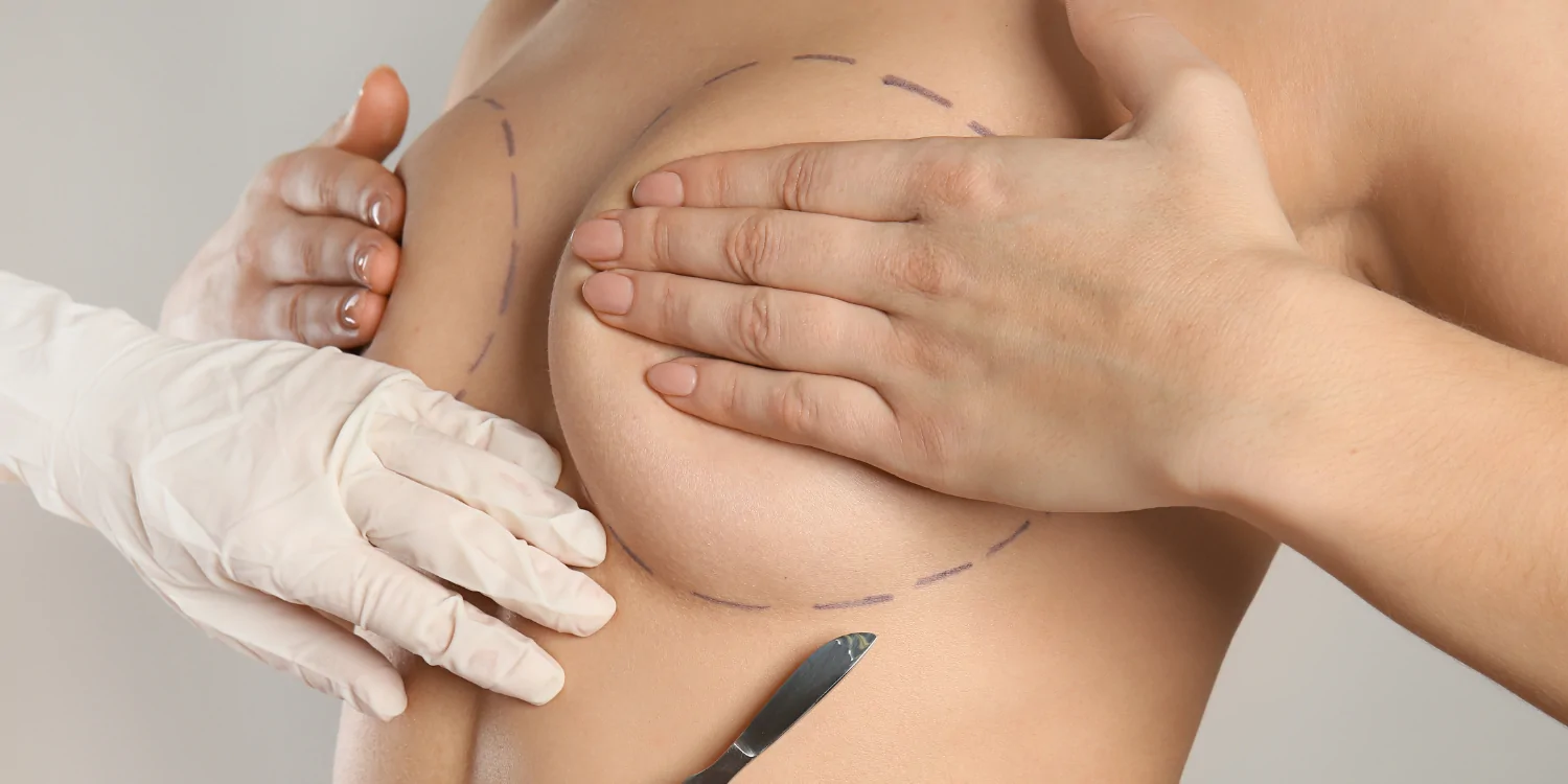 Breast Surgery Guide: Augmentation vs Reduction – Which One Is Right for You?