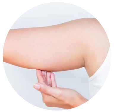 Liposuction of Arms