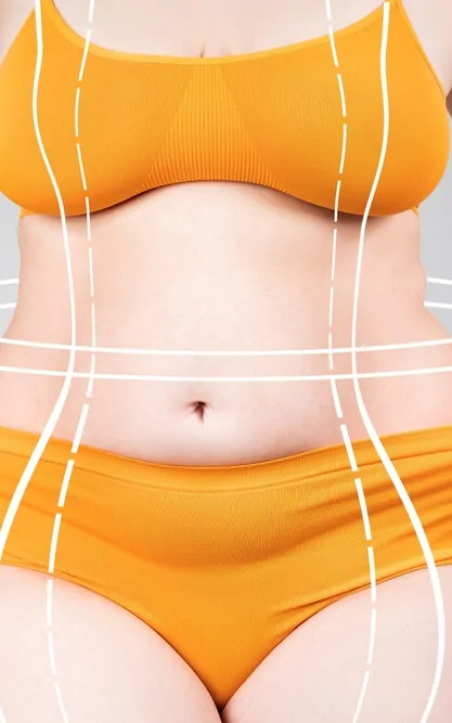 Body Lift Surgery procedures at Kayakriti