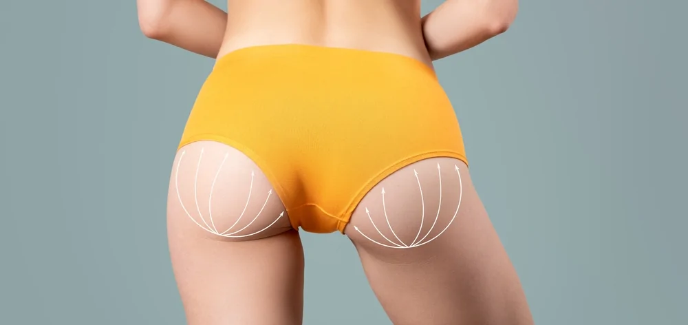 Butt Augmentation — hero image