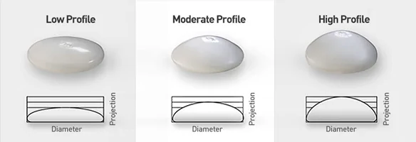 Breast Augmentation