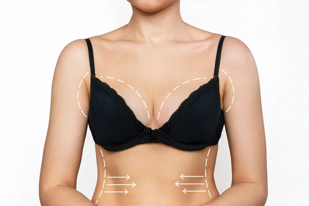 Breast Reduction — hero image