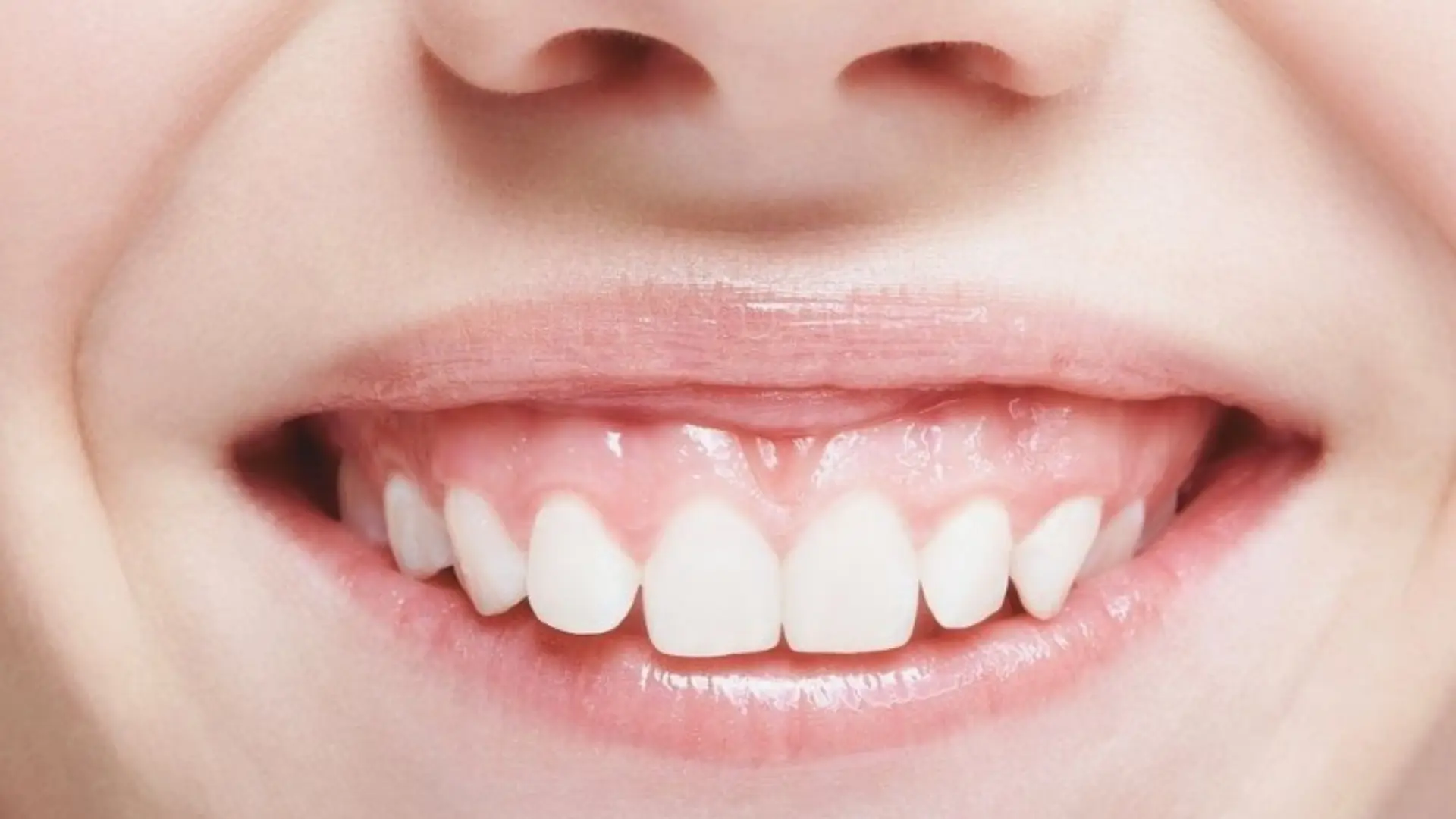 Smile procedures at Kayakriti