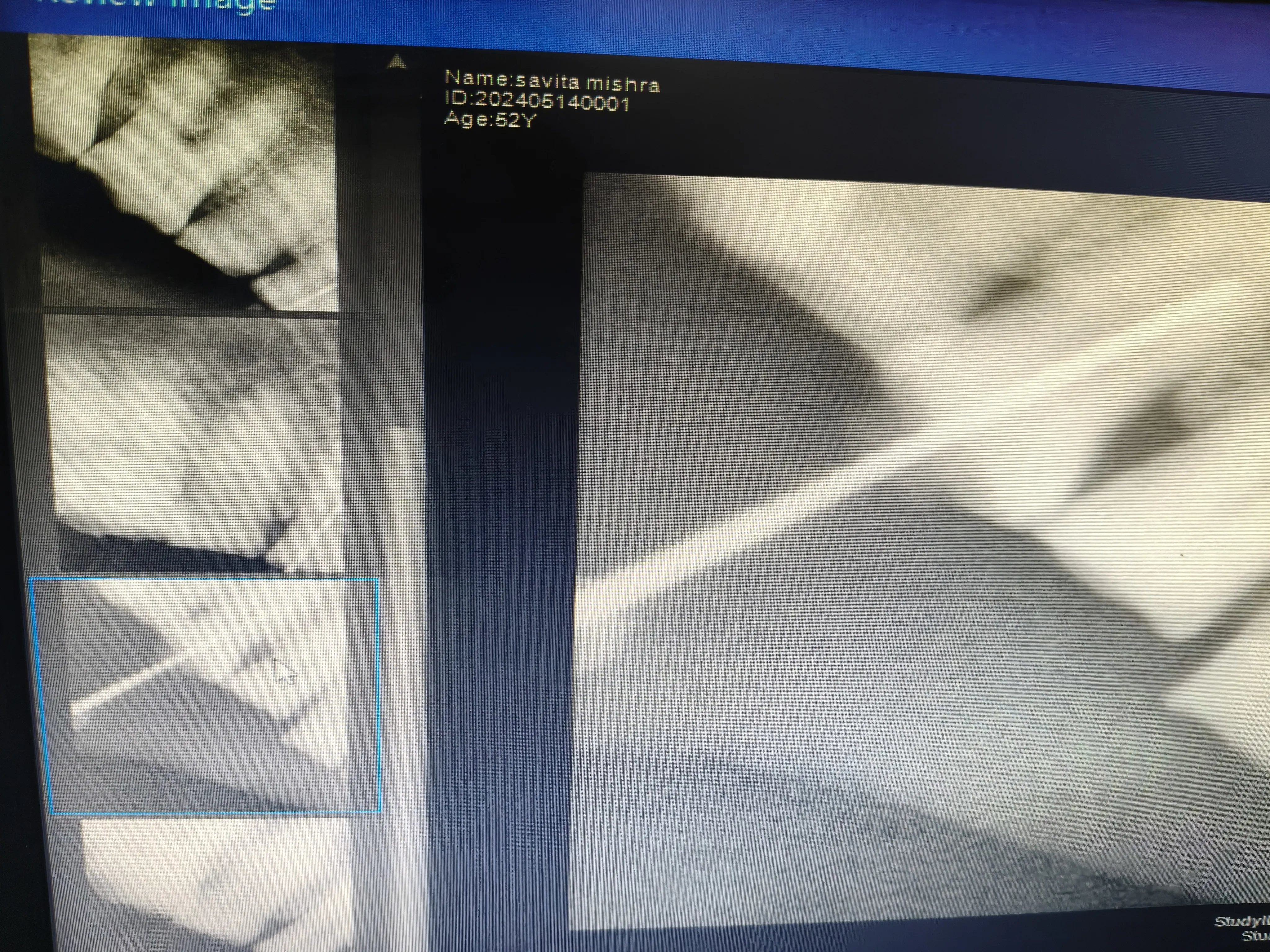 Sample X-ray Scans