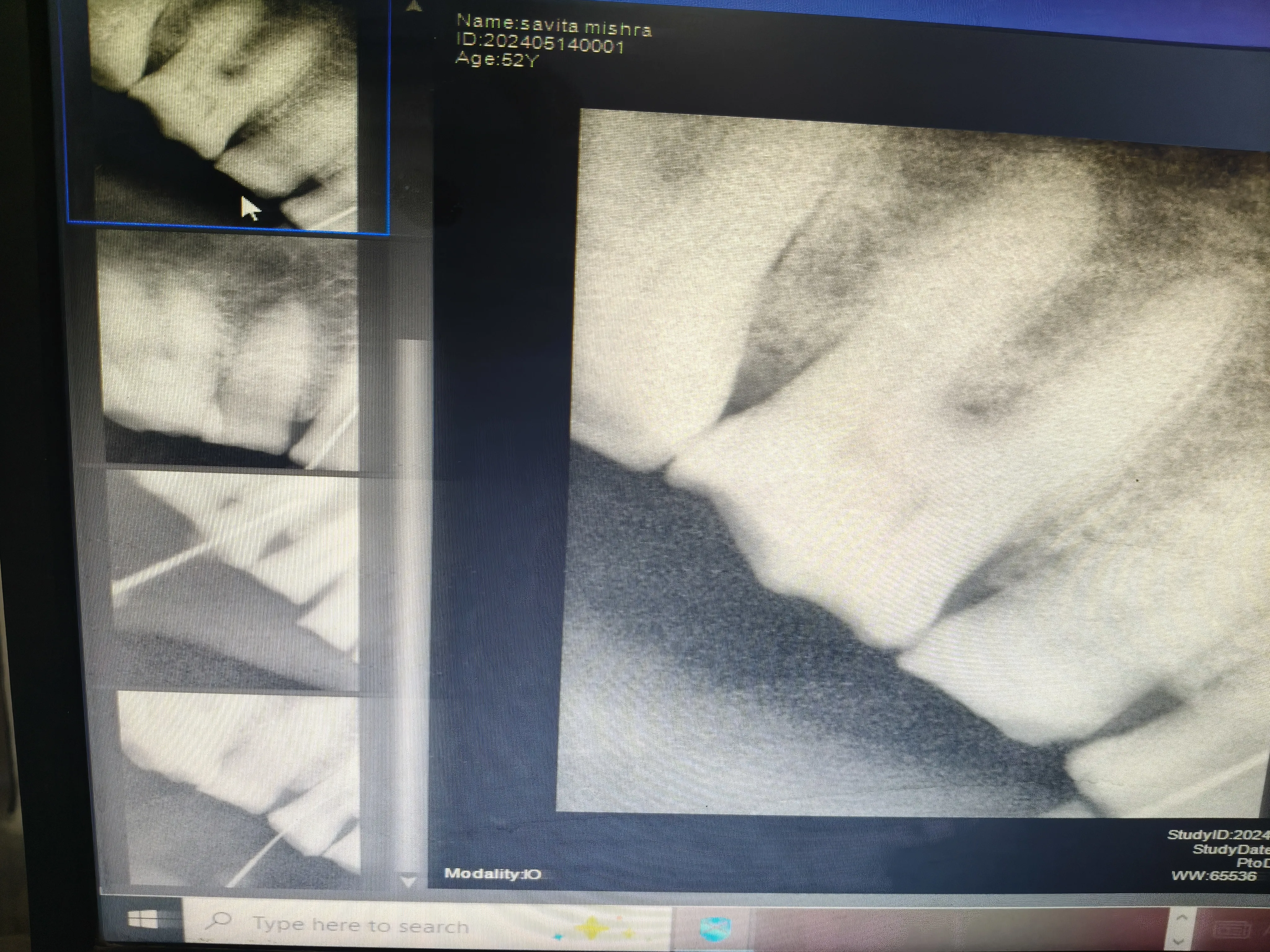 Sample X-ray Scans
