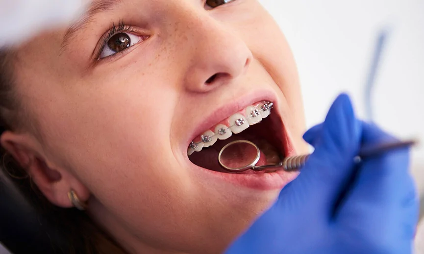 Fixed Orthodontic Appliances — hero image
