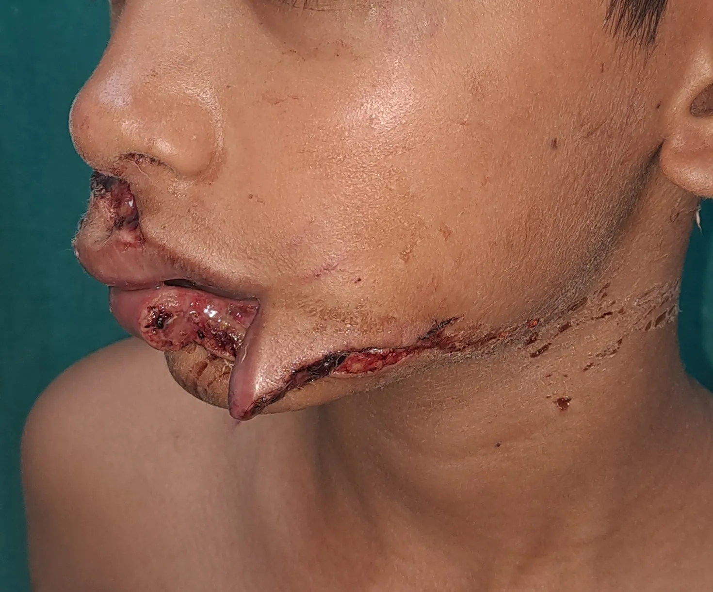 Face — hero image