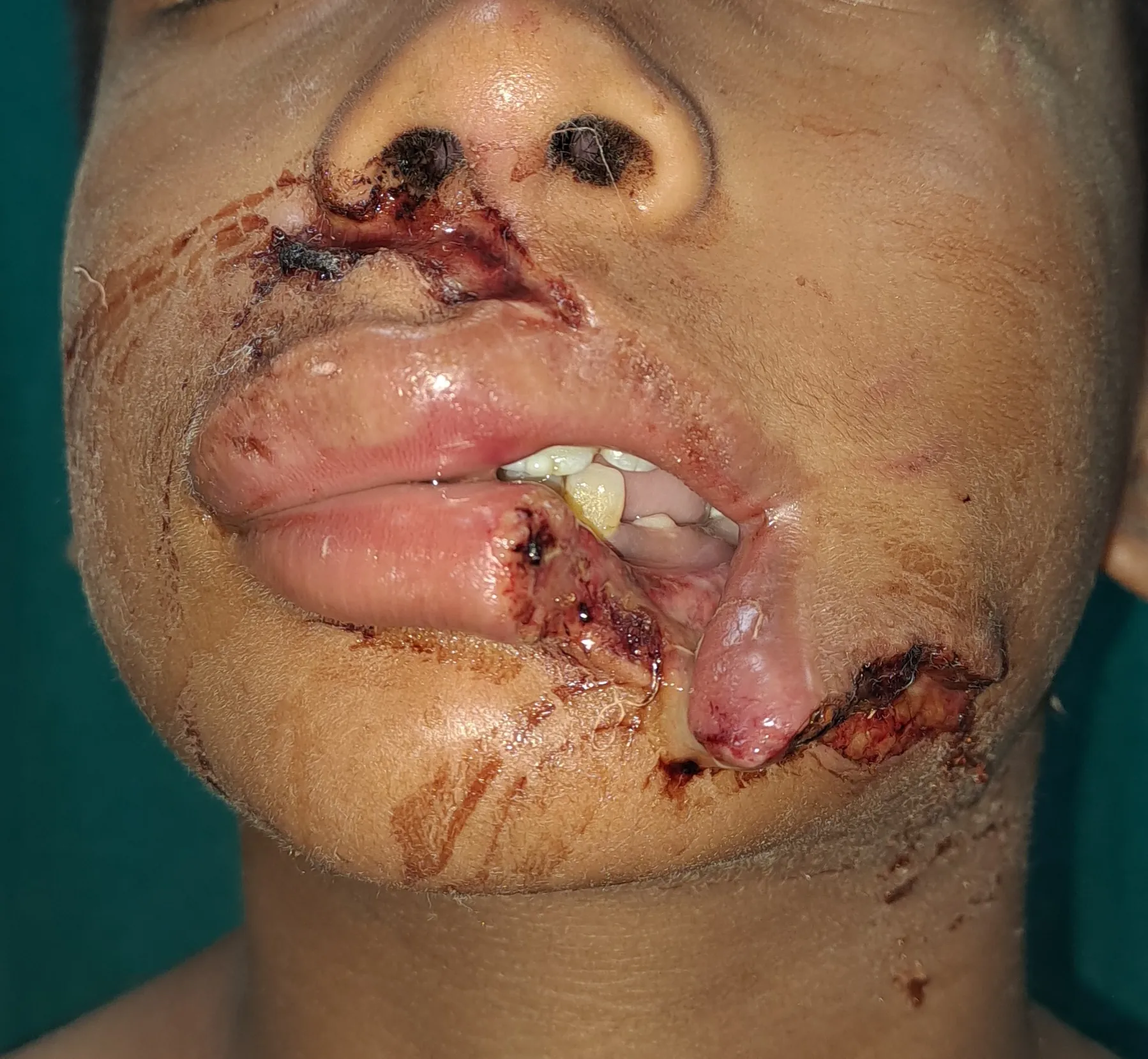Face Injuries — before