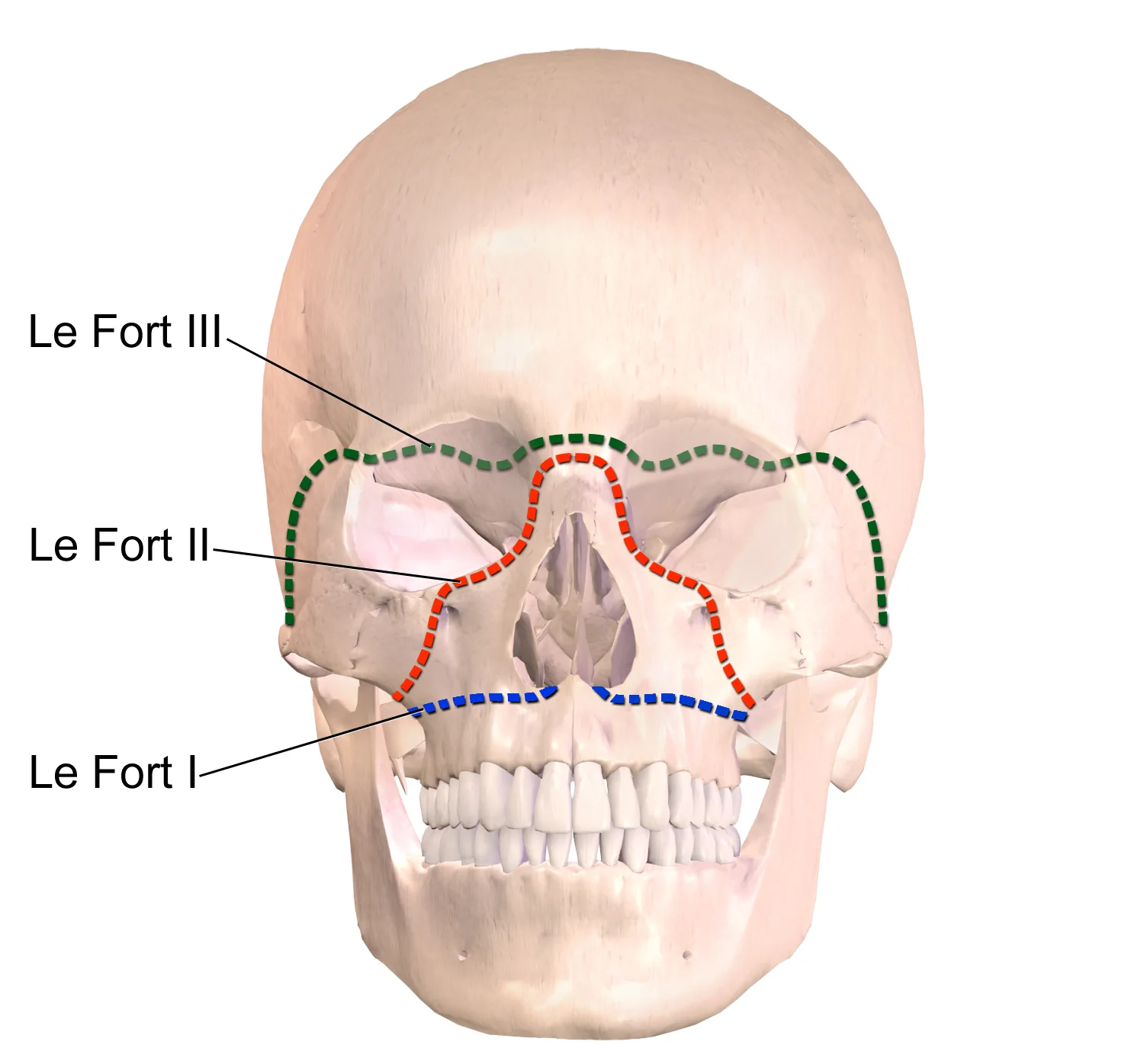 Facial Fractures — hero image