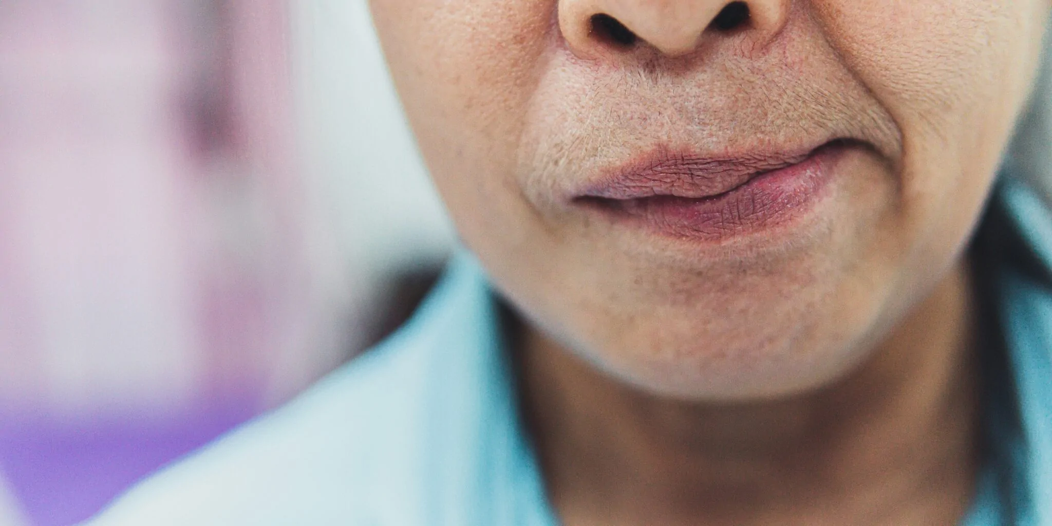 Facial Nerve Palsy — hero image