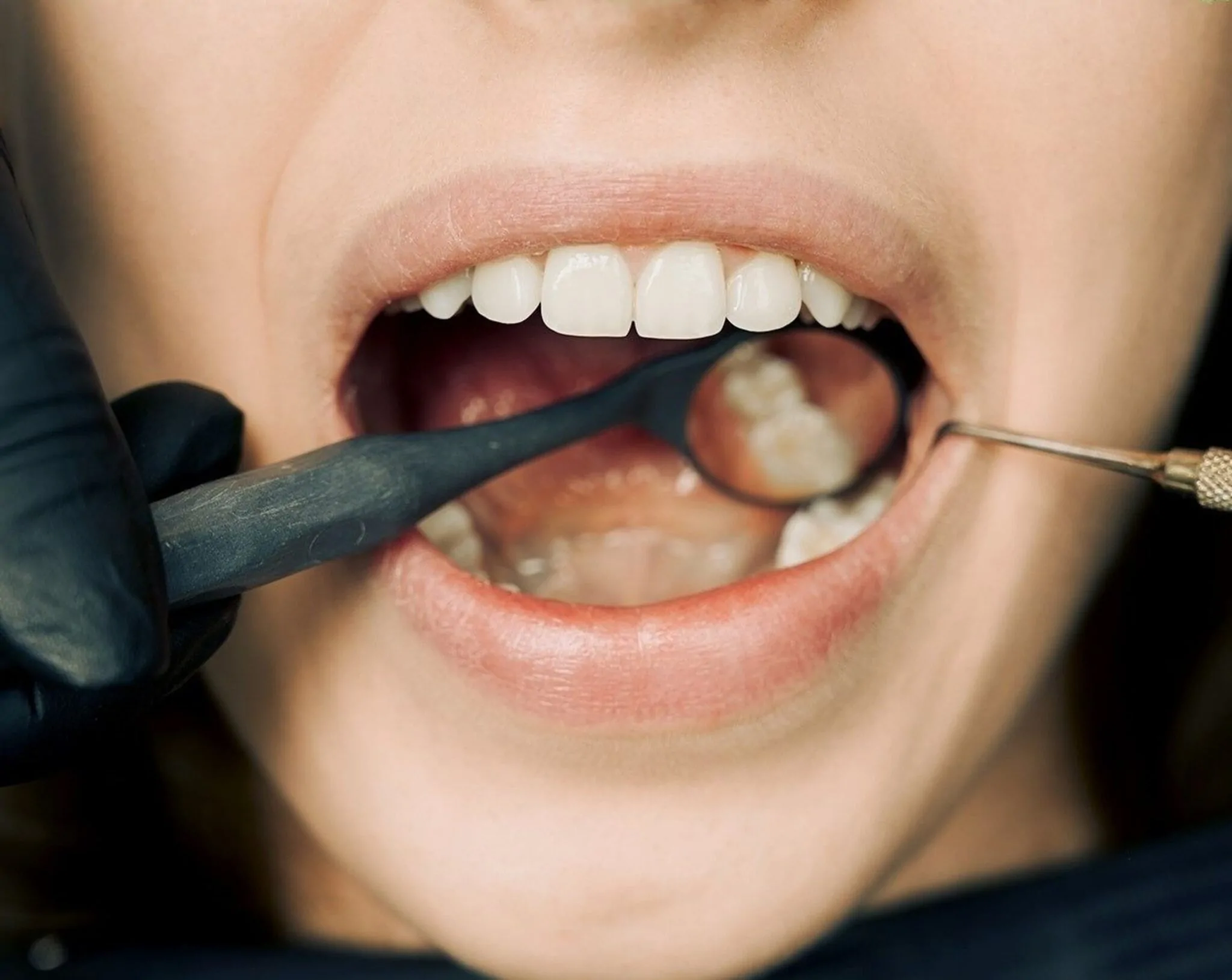 Oral Cancer — hero image