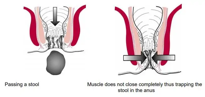 Genitalia procedures at Kayakriti