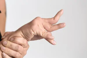 Cerebral Palsy Hand Deformity