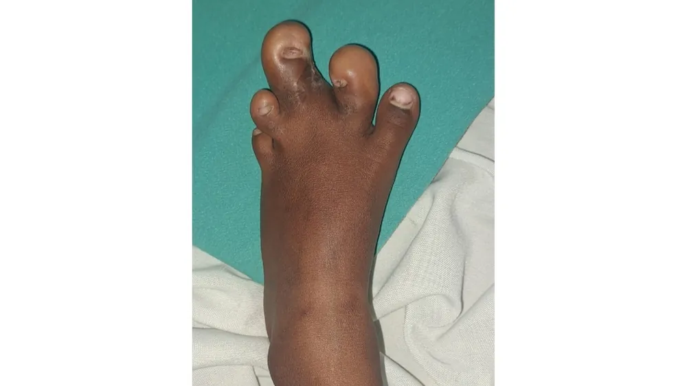 Before surgery