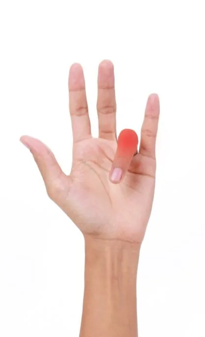 Trigger Finger