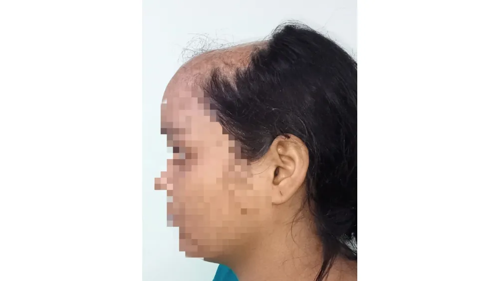 Before surgery