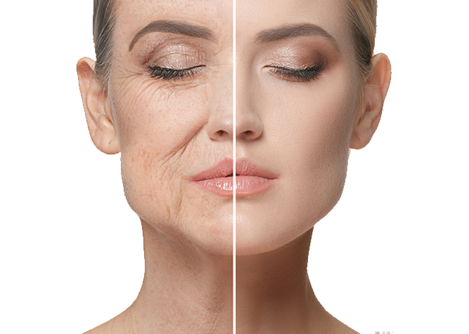 Facial Rejuvenation for Aging